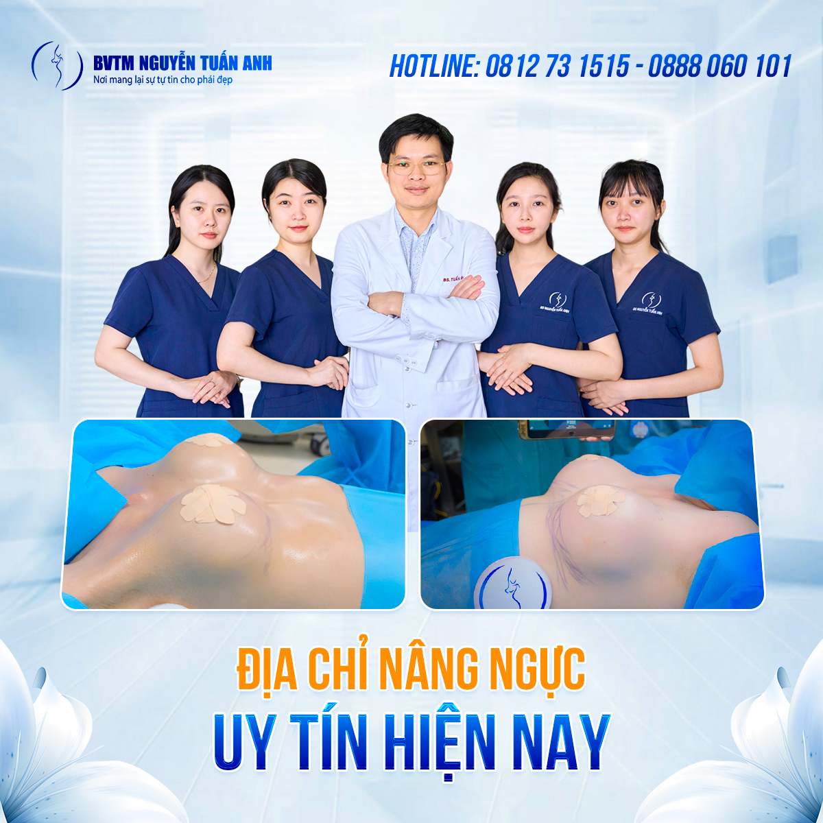 Nâng ngực nội soi là gì? Địa chỉ nâng ngực uy tín hiện nay